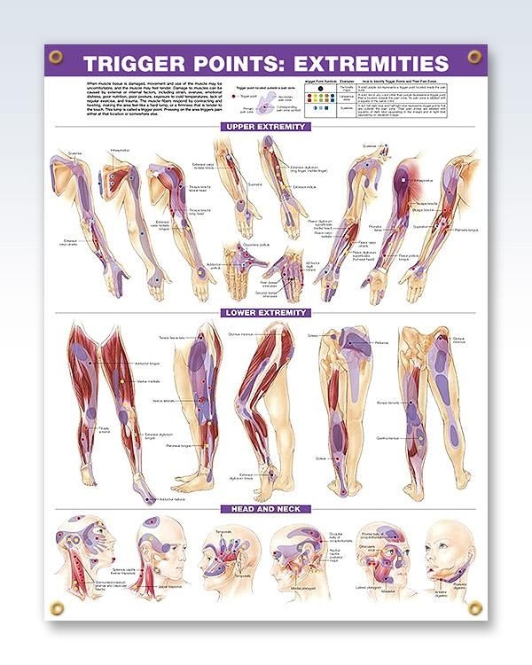 Printable Trigger Points Chart